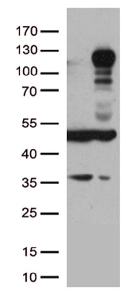 LEMD3 Mouse anti-Canine, Human, Clone: OTI3H2, lyophilized, TrueMAB 100