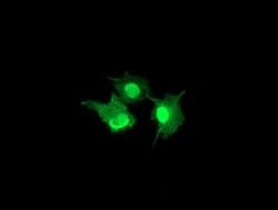 LENG1 Monoclonal Antibody (OTI1E6), TrueMAB , OriGene 100 &mu;L; Unconjugated:Antibodies,