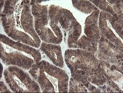LEPRE1 Monoclonal Antibody (OTI1H3), TrueMAB , OriGene 100 &mu;L; Unconjugated:Antibodies,