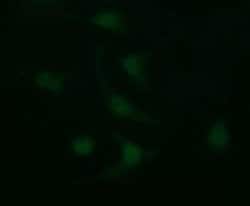 LGALS3 Monoclonal Antibody (OTI1G8), TrueMAB , OriGene 100 &mu;L; Unconjugated:Antibodies,