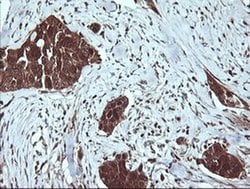 LGALS3 Monoclonal Antibody (OTI1A2), TrueMAB , OriGene 100 &mu;L; Unconjugated:Antibodies,