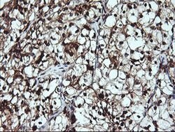 LGALS3 Monoclonal Antibody (OTI1A2), TrueMAB , OriGene 100 &mu;L; Unconjugated:Antibodies,
