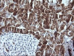 LGALS3 Monoclonal Antibody (OTI1G8), TrueMAB , OriGene:Antibodies:Primary