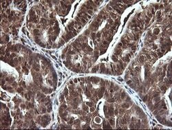 LGALS3 Monoclonal Antibody (OTI1G8), TrueMAB , OriGene 100 &mu;L; Unconjugated:Antibodies,