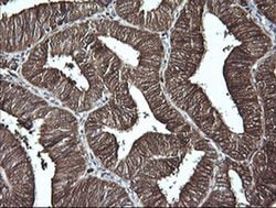 LGALS3 Monoclonal Antibody (OTI1G8), TrueMAB , OriGene:Antibodies:Primary