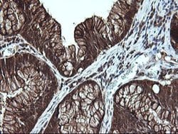 LGALS3 Monoclonal Antibody (OTI1G8), TrueMAB , OriGene 100 &mu;L; Unconjugated:Antibodies,