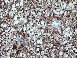 LGALS3 Monoclonal Antibody (OTI1G8), TrueMAB , OriGene 100 &mu;L; Unconjugated:Antibodies,