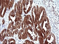 LGALS3 Monoclonal Antibody (OTI1A1), TrueMAB , OriGene 100 &mu;L; Unconjugated:Antibodies,