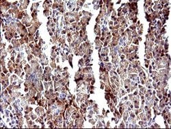 LGALS3 Monoclonal Antibody (OTI1A1), TrueMAB , OriGene 100 &mu;L; Unconjugated:Antibodies,