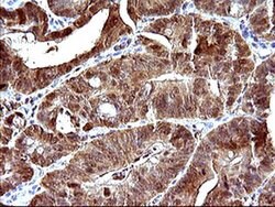 LGALS3 Monoclonal Antibody (OTI1A1), TrueMAB , OriGene 100 &mu;L; Unconjugated:Antibodies,
