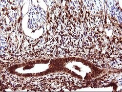 LGALS3 Monoclonal Antibody (OTI1A1), TrueMAB , OriGene:Antibodies:Primary