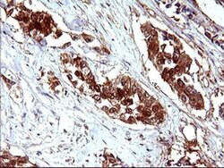LGALS3 Monoclonal Antibody (OTI1A1), TrueMAB , OriGene 100 &mu;L; Unconjugated:Antibodies,