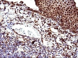 LGALS3 Monoclonal Antibody (OTI1A1), TrueMAB , OriGene 100 &mu;L; Unconjugated:Antibodies,