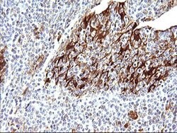 LGALS3 Monoclonal Antibody (OTI1A1), TrueMAB , OriGene 100 &mu;L; Unconjugated:Antibodies,