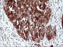 LGALS3 Monoclonal Antibody (OTI1A1), TrueMAB , OriGene 100 &mu;L; Unconjugated:Antibodies,