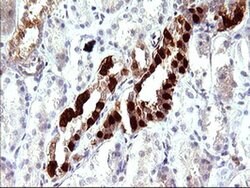 LGALS3 Monoclonal Antibody (OTI1A1), TrueMAB , OriGene:Antibodies:Primary