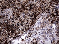 LGALS3 Monoclonal Antibody (OTI1C7), TrueMAB , OriGene 100 &mu;L; Unconjugated:Antibodies,