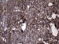 LGALS3 Monoclonal Antibody (OTI1C7), TrueMAB , OriGene 100 &mu;L; Unconjugated:Antibodies,