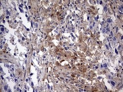 LGALS3 Monoclonal Antibody (OTI1C7), TrueMAB , OriGene 100 &mu;L; Unconjugated:Antibodies,