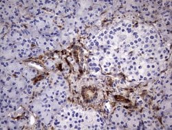 LGALS3 Monoclonal Antibody (OTI1C7), TrueMAB , OriGene:Antibodies:Primary