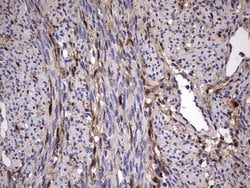 LGALS3 Monoclonal Antibody (OTI1C7), TrueMAB , OriGene 100 &mu;L; Unconjugated:Antibodies,