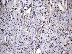 LGALS3 Monoclonal Antibody (OTI1C7), TrueMAB , OriGene 100 &mu;L; Unconjugated:Antibodies,