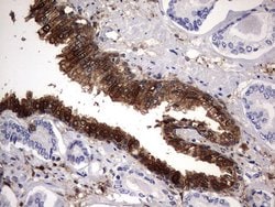 LGALS3 Monoclonal Antibody (OTI1C7), TrueMAB , OriGene 100 &mu;L; Unconjugated:Antibodies,