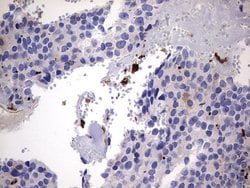 LGALS3 Monoclonal Antibody (OTI1C7), TrueMAB , OriGene 100 &mu;L; Unconjugated:Antibodies,