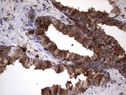 LGALS3 Monoclonal Antibody (OTI1C7), TrueMAB , OriGene 100 &mu;L; Unconjugated:Antibodies,
