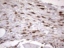 LGALS3 Monoclonal Antibody (OTI1C7), TrueMAB , OriGene 100 &mu;L; Unconjugated:Antibodies,