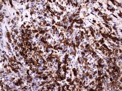 LGALS3 Monoclonal Antibody (OTI1C7), TrueMAB , OriGene 100 &mu;L; Unconjugated:Antibodies,