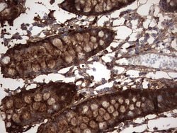 LGALS3 Monoclonal Antibody (OTI1C7), TrueMAB , OriGene 100 &mu;L; Unconjugated:Antibodies,