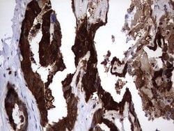 LGALS3 Mouse anti-Human, Clone: OTI1C7, lyophilized, TrueMAB 100 &mu;g;