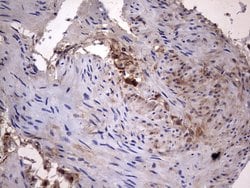 LGALS3 Monoclonal Antibody (OTI1C7), TrueMAB , OriGene 100 &mu;L; Unconjugated:Antibodies,