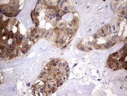 LGALS3 Monoclonal Antibody (OTI1C7), TrueMAB , OriGene 100 &mu;L; Unconjugated:Antibodies,