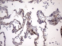 LGALS3 Monoclonal Antibody (OTI1C7), TrueMAB , OriGene 100 &mu;L; Unconjugated:Antibodies,