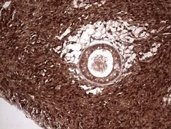 LGALS3 Mouse anti-Human, Clone: OTI2F1, lyophilized, TrueMAB 100 &mu;g;