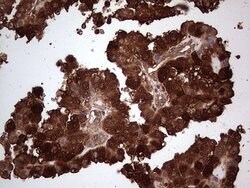 LGALS3 Mouse anti-Human, Clone: OTI2F1, lyophilized, TrueMAB 100 &mu;g;