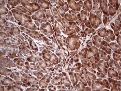 LGALS3 Mouse anti-Human, Clone: OTI2F1, lyophilized, TrueMAB 100 &mu;g;