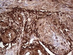 LGALS3 Mouse anti-Human, Clone: OTI2F1, lyophilized, TrueMAB 100 &mu;g;
