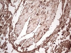 LGALS3 Mouse anti-Human, Clone: OTI2F1, lyophilized, TrueMAB 100 &mu;g;