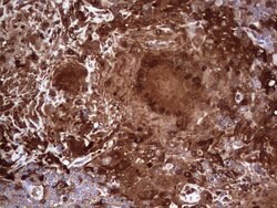 LGALS3 Mouse anti-Human, Clone: OTI2F1, lyophilized, TrueMAB 100 &mu;g;