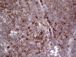 LGALS3 Mouse anti-Human, Clone: OTI2F1, lyophilized, TrueMAB 100 &mu;g;