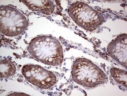 LGALS3 Mouse anti-Human, Clone: OTI2F1, lyophilized, TrueMAB 100 &mu;g;