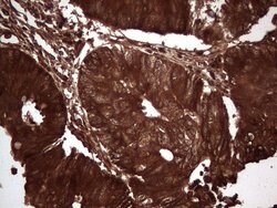 LGALS3 Mouse anti-Human, Clone: OTI2F1, lyophilized, TrueMAB 100 &mu;g;