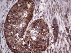 LGALS3 Mouse anti-Human, Clone: OTI2F1, lyophilized, TrueMAB 100 &mu;g;
