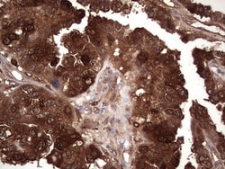 LGALS3 Monoclonal Antibody (OTI7G9), TrueMAB , OriGene 30 &mu;L | Buy Online | Origene Technologies | Fisher Scientific