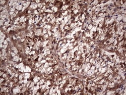 LGALS3 Monoclonal Antibody (OTI7G9), TrueMAB , OriGene 30 &mu;L | Buy Online | Origene Technologies | Fisher Scientific