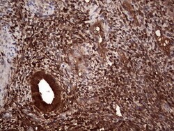 LGALS3 Monoclonal Antibody (OTI7G9), TrueMAB , OriGene 30 &mu;L | Buy Online | Origene Technologies | Fisher Scientific