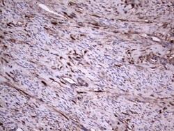 LGALS3 Monoclonal Antibody (OTI7G9), TrueMAB , OriGene 30 &mu;L | Buy Online | Origene Technologies | Fisher Scientific